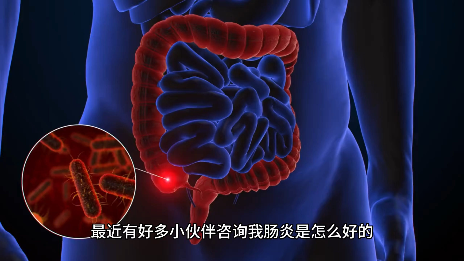 智能肠炎康复系统引领新时代治疗突破