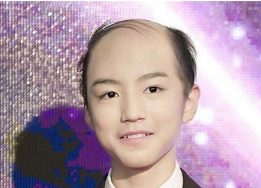 秃头的男演员,形象背后的故事与探索