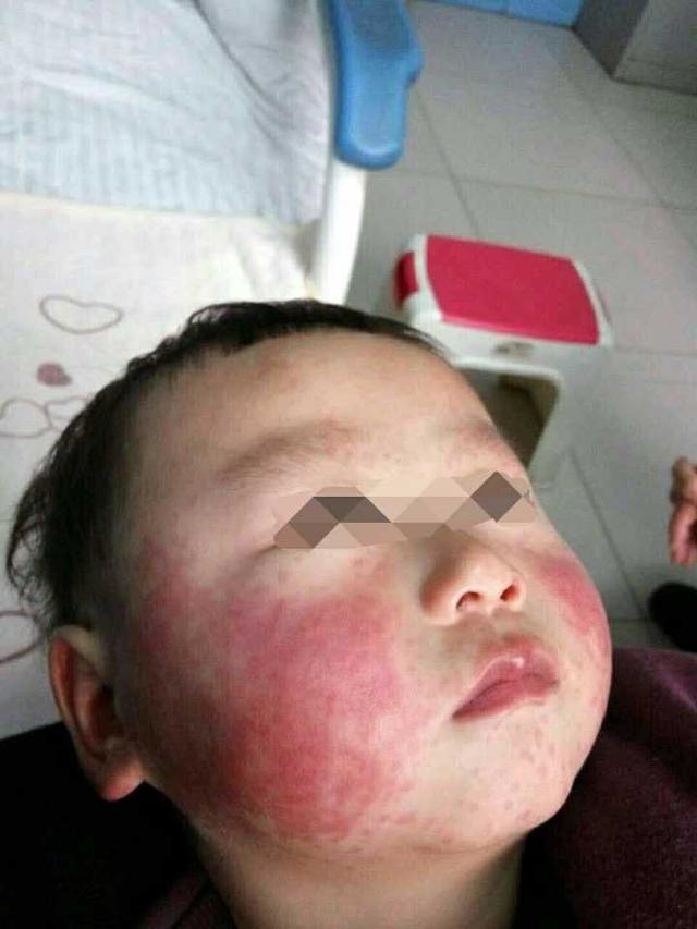 最新儿童禁药，时代的警钟与儿童健康守护的双重关注